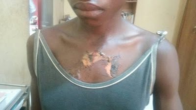 See the Horrific Abuse wife to high Ranking Abuja Policeman allegedly Meted out on girl
