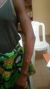 See the Horrific Abuse wife to high Ranking Abuja Policeman allegedly Meted out on girl