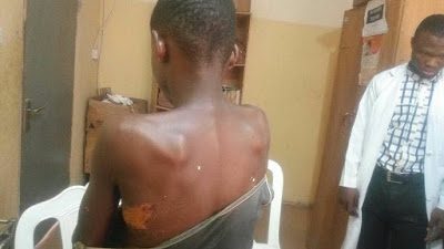 See the Horrific Abuse wife to high Ranking Abuja Policeman allegedly Meted out on girl